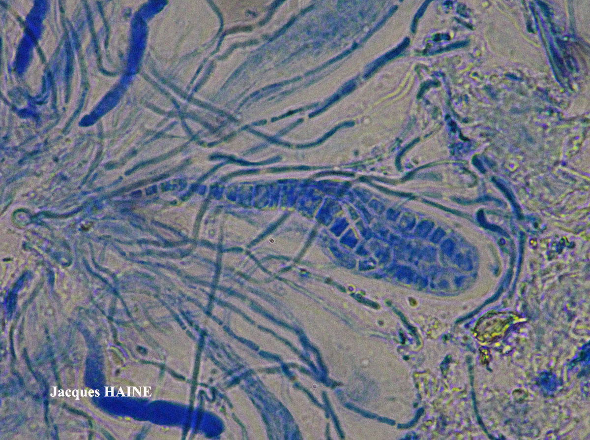 Aquacidia antricola (Taylor) Aptroot